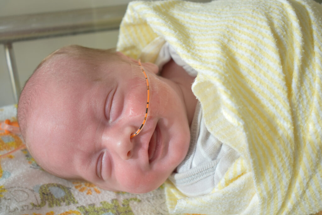 Sonda NG O que esperar após o procedimento